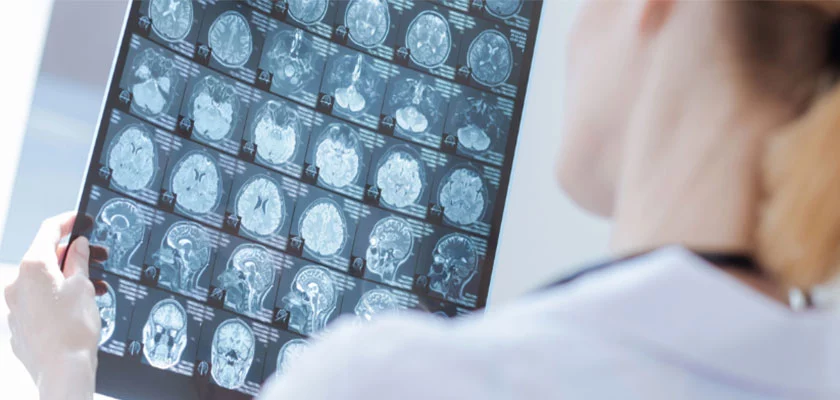 distinction-improved-ux-for-the-society-college-of-radiographers-